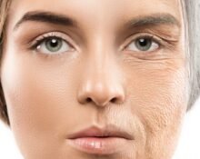 Alles-wat-je-wilt-weten-over-rimpels