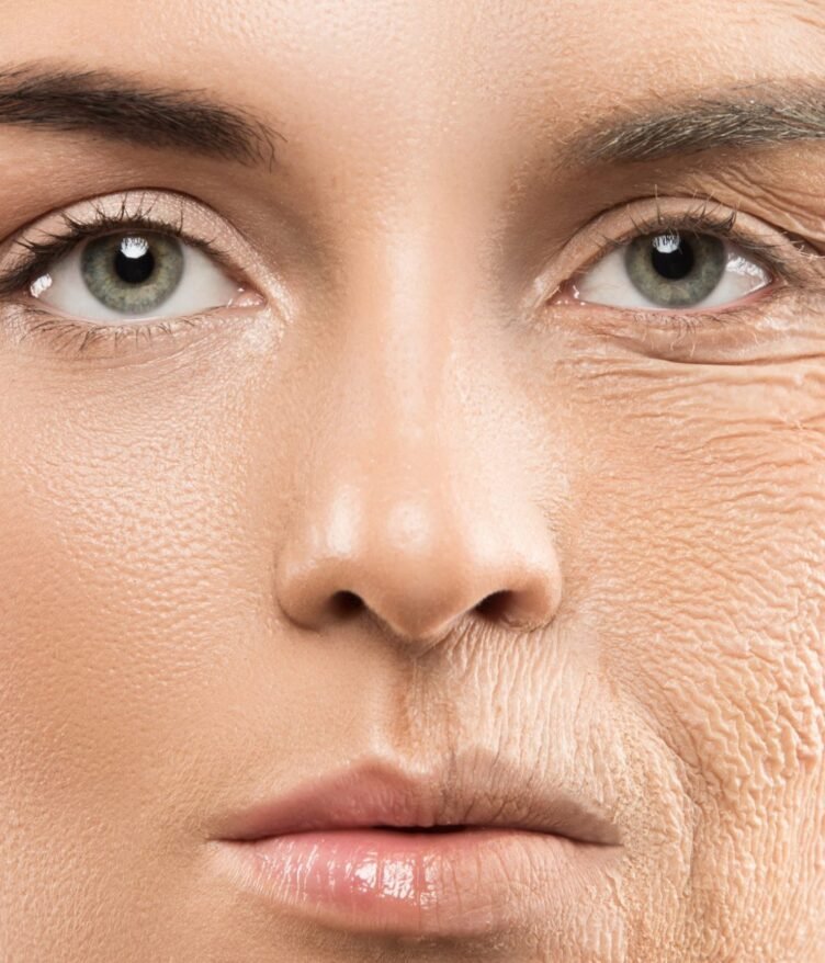 Alles-wat-je-wilt-weten-over-rimpels